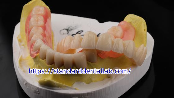 Beli Estetika Tinggi Dental TCS Valplast Fleksibel Parsial Gigi Gigi Laboratorium Dental Valplast Clamp Warna Pink pembuatan online