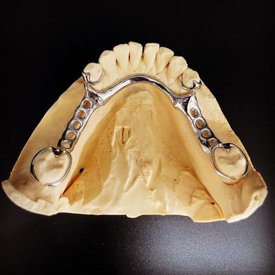 Beli Fast and Cast Frame Co-Cr Metal Partial Denture Framework untuk Profesional Gigi pembuatan online