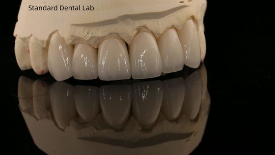 Beli Full Contour Zirconia Crown dan High Aesthetic Natural Dental Bridge Jaminan 5 Tahun pembuatan online
