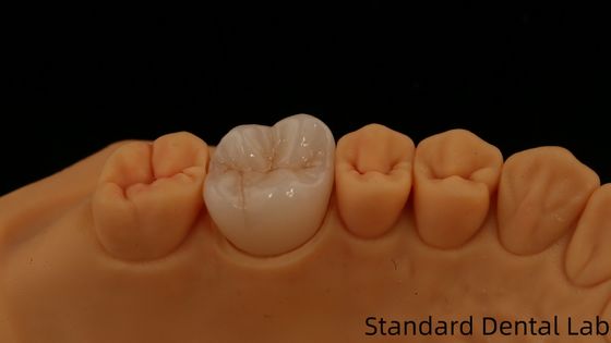 Beli Noritake Porselen Full Contour Zirconia Crown Disesuaikan Vita Shade untuk Estetika Digital Restorasi Gigi oleh Lab Gigi pembuatan online