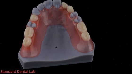 Beli 3D Print Model Estetika Tinggi Gigi TCS Valplast Fleksibel Bagian Gigi Gigi Lab Gigi pembuatan online