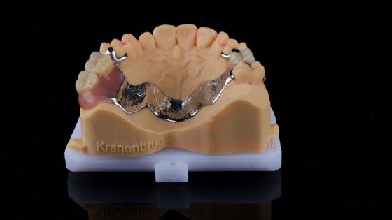 Beli Dentitas Cobalt Chrome parsial Ivoclar Scheftner Kerangka logam nyaman dikirim hanya dalam 3 hari pembuatan online