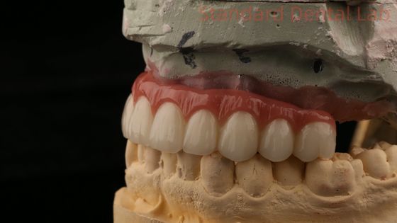 Beli Hybrid Titanium Screw Retained Dental Implant Crown All On 4 Dental Implant Zirconia Bridge pembuatan online