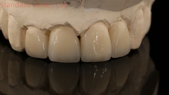Beli Kuat Lapisan Zirconia Mahkota Dan Jembatan Dalam Estetika Baik Zirconia Lapisan China Dental Lab pembuatan online