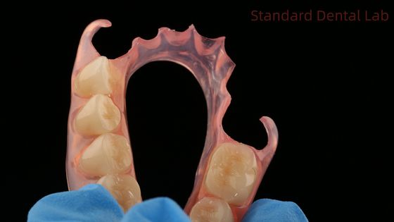 Beli Dental TCS Valplast Fleksibel Parsial Gigi Gigi Laboratorium Gigi 3D Print Model Estetika Tinggi pembuatan online