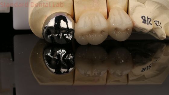 Beli Vita Porcelain Full Metal Crown Dengan Post Core 3 Tahun Garansi dari Lab Gigi pembuatan online