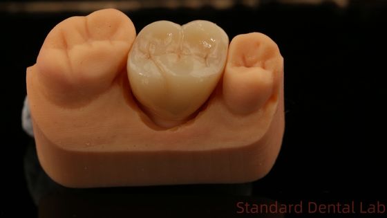 Beli Mill dan Centering Full Zirconia Crown, China Dental Lab Pengiriman cepat pembuatan online