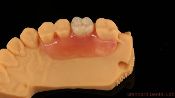 Beli Dental TCS Valplast Fleksibel Parsial Gigi Nesbit Valplast Finish Cina Dental Lab Valplast Clamp pembuatan online