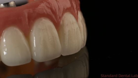 Beli Profesional Zirconia Implan Gigi Mahkota Titanium CAD CAM Zirconia Mahkota China Dental Lab pembuatan online