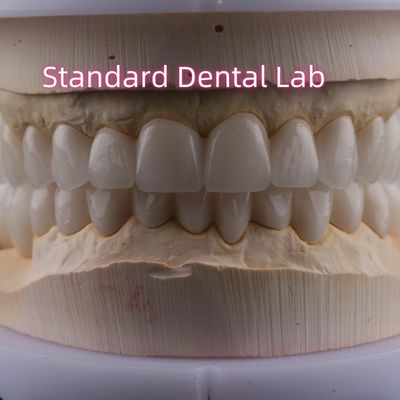Dental Lab Full Arch Zirconia Porselen Mahkota PFZ Mahkota ISO FDA CE