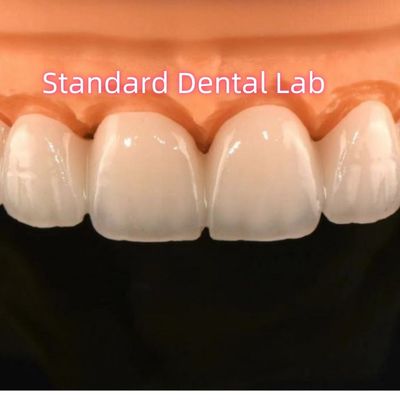 Zirconia Crown Bridge Dental Lab Dengan Porselen Berlapis