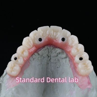 Porselen Zirconia Jembatan Implan Gigi Profesional Estetika Tinggi Dengan Permen karet Pink