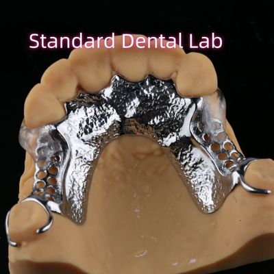 Pencetakan Laser Cobalt Chrome Parsial Denture Dengan Clamps Jelas