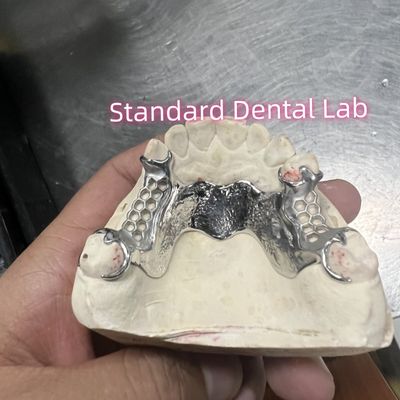 Cobalt Chrome Cast Frame Parsial Denture Vitallium 2000