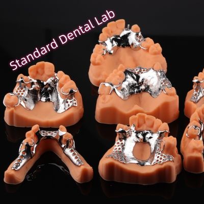 CAD CAM Removable Parcial Denture Metal Frame 3Shape Desain Denture Exocad