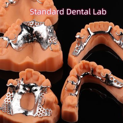 Cetak CoCr Denture Skeletal Chrome Metal Parsial Denture Desain