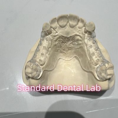 Penghapus Cast Clear Frame Parsial Mudah untuk membersihkan dan lepas landas