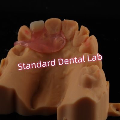 Bagian atas Valplast gigi palsu sisi satu removable Fleksibel satu gigi Gigi parsial