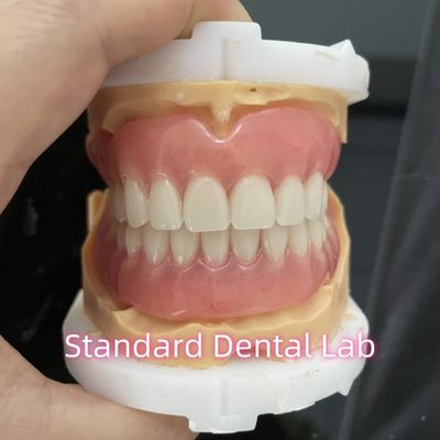 OEM Standard Dental Lab Full Removable Dentures Mudah Untuk Mengambil In Dan Out