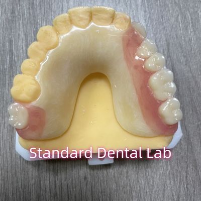 OEM Removable Cast Tooth Shade Acrylic Parsial Denture Dengan Klip