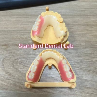 Estetika Hiasan Gigi Frame Asetil Cat gigi berwarna Ivoclar Set