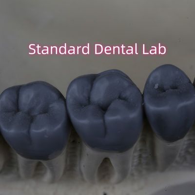 Profesional Digital Dental Lab Wax Up 3shape FDA Disetujui