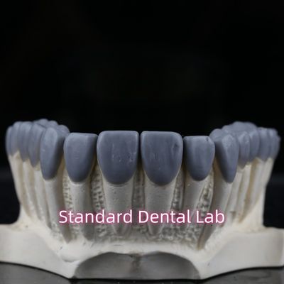 Standar Dental Lab Dental Crown Wax Up Estetika Tinggi