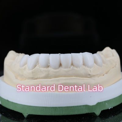 Diagnostik Restoratif Kedokteran Gigi Wax Up Veneers Estetika Tinggi