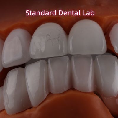 Lithium Dicilicate lapisan Ivoclar Emax Zirconia Laminate Veneers Translucent OEM ODM