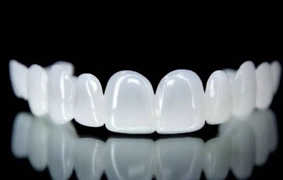 Penggantian Snap On Veneers Snow White Shade Good Fit Layanan Desain Gigi
