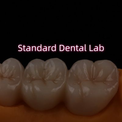 High Translucent PFZ Layered Zirconia Bridge Porcelain Keramik Belakang