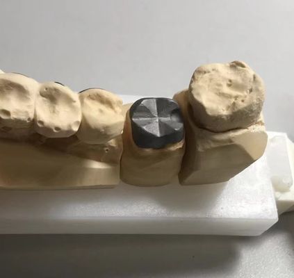 ISO FDA CE Dental Metal Post Dan Core Crown PFM Good Fit