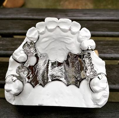 Cobalt Chrome Removable Parsial Denture Frame Pencetakan Laser Ni Be Gratis