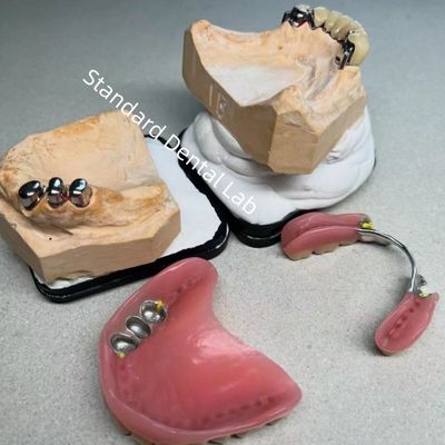 Estetika Tinggi CAD CAM Gigi Bagian Pergantian Pergantian Dental Laboratorium Standar