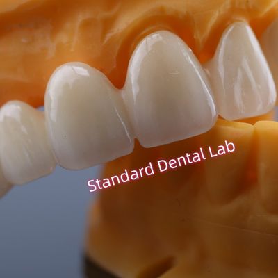 CAD CAM Mill Zirconia Crown Bridge Sangat Biokompatibel