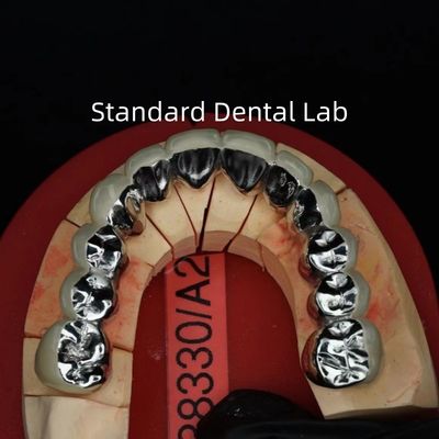 Full Arch Metal Porselen Mahkota / Jembatan Precise Esthetic PFM Mahkota Gigi