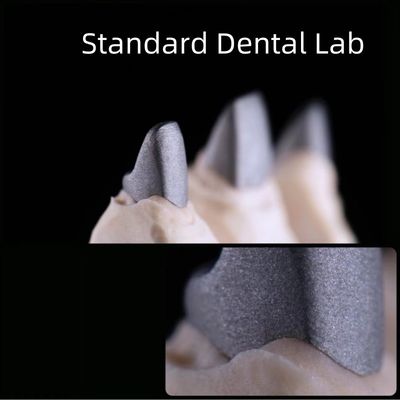 Laboratorium Dental Standar Dental Metal Post Dan Core Crown Co