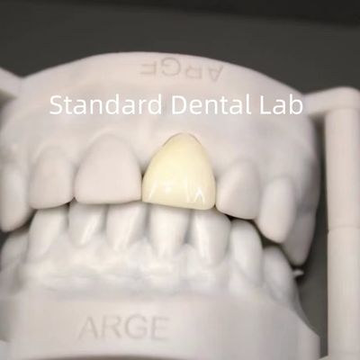 Digital CAD CAM Dental Lab Mahkota Translucent Lapisan Zirconia Mahkota