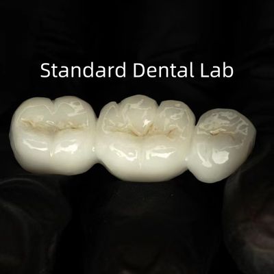 Full Contour Tinggi Translucence Solid Zirconia