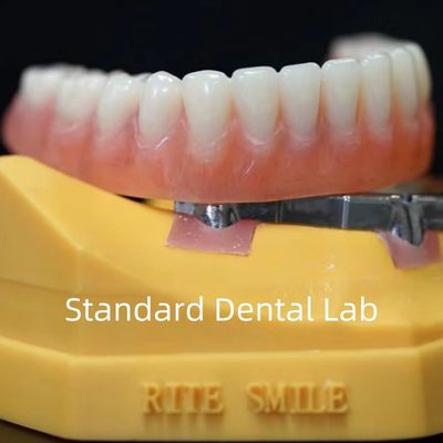Titanium Implant Dukungan Gigi Praktis Ivoclar Denture Over Implants ISO FDA CE