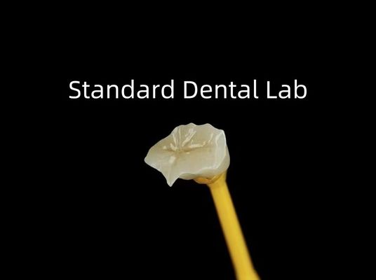 Dental Porselen Inlay Onlay Zirconia Emax Estetika Tinggi