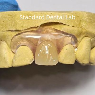 Dental TCS Valplast Fleksibel Parsial Dentures Mencelupkan Menghilang Bau tahan