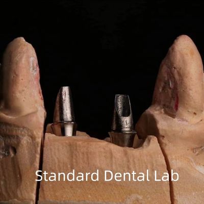 Dental Porselen Zirconia Implant Crown Profesional Estetika Tinggi