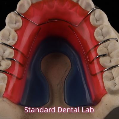 Peralatan Ortodontik Gigi Yang Bisa Dihapus Hawley Retainer