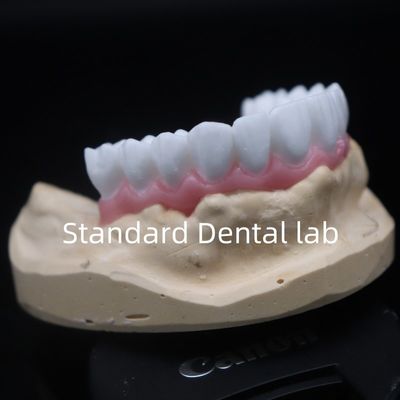 Tinggi Estetika Putih Dental Crown Diagnostic Wax Up Disesuaikan China Dental Lab