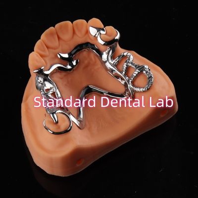 Cobalt Chrome Framework Ni Be Free gigi palsu yang bisa dilepas China Dental Lab