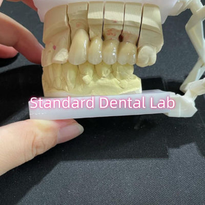 Dibuang PFM Non-Elyseous CoCr Metal Porcelain Bridge Dental CCM