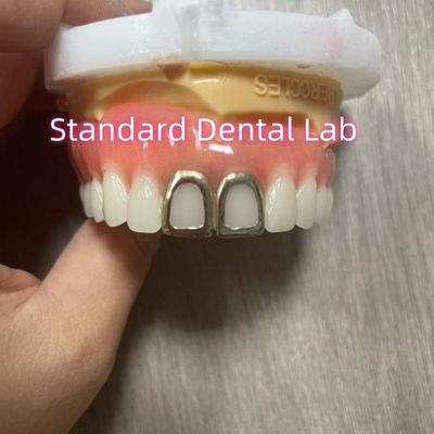ISO Full Acrylic Dentures Dengan Gigi Emas Kuning Muka Terbuka