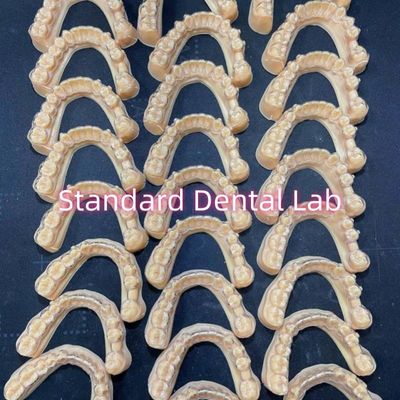 Profesional Gigi Ortodontik Invisalign Clear Retainers Rencana Pengobatan