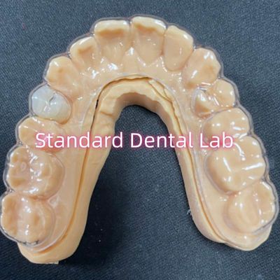 Professional Orthodontic Retainer Clear Essix Retainers Dengan Gigi Resin Akrilik yang Stabil